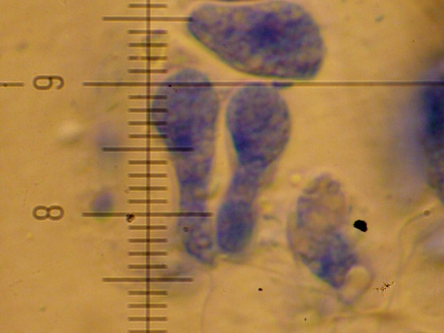 Lindtneria trachyspora (Tulasnella violea)